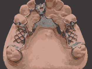 ͨݲPע^c-⺸ӼӹԒ